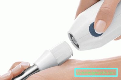 Fúvókák a Bosch turmixgéphez Fúvókák a Bosch turmixgéphez